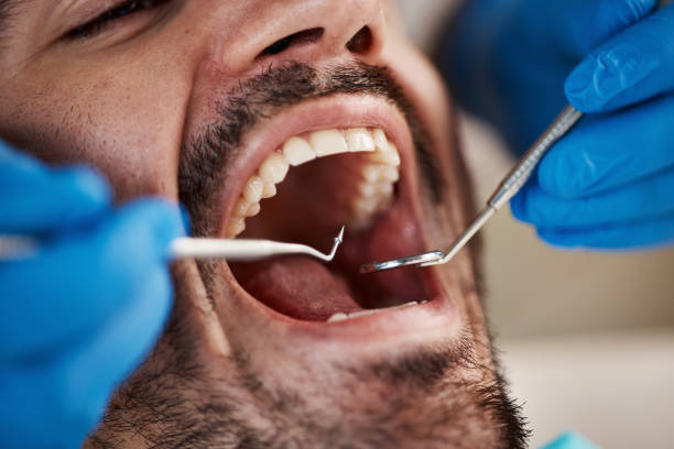 Best Emergency Broken Tooth Repair in Cheraw, SC